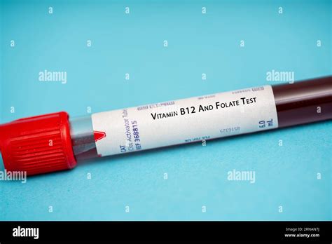 vitamin b12 blood test bottle|b12 and folate lab tests.